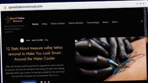 Publish Guest Post on speedtattooremoval.com