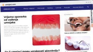 Publish Guest Post on umnjaci.com