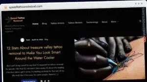 Publish Guest Post on speedtattooremoval.com