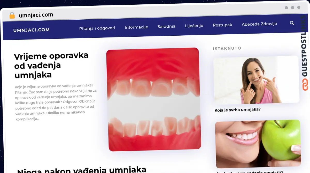 Publish Guest Post on umnjaci.com