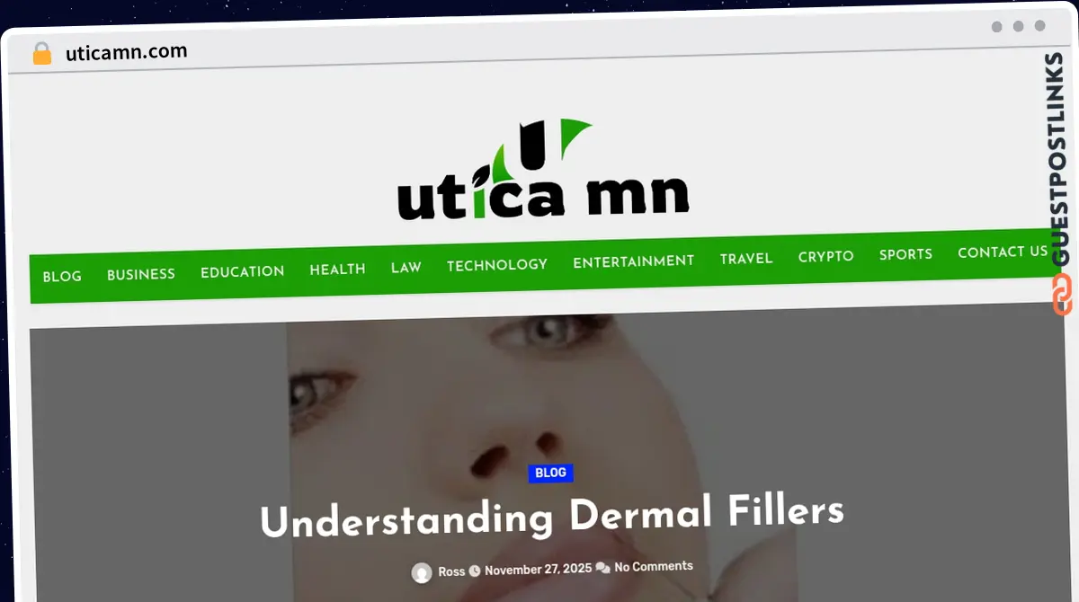 Publish Guest Post on uticamn.com