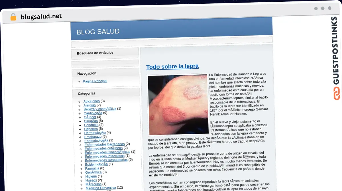 Publish Guest Post on blogsalud.net