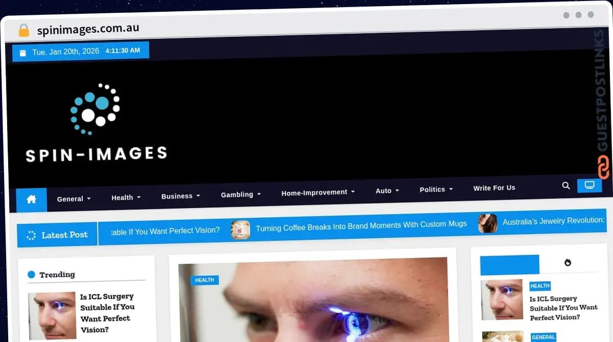 Publish Guest Post on spinimages.com.au