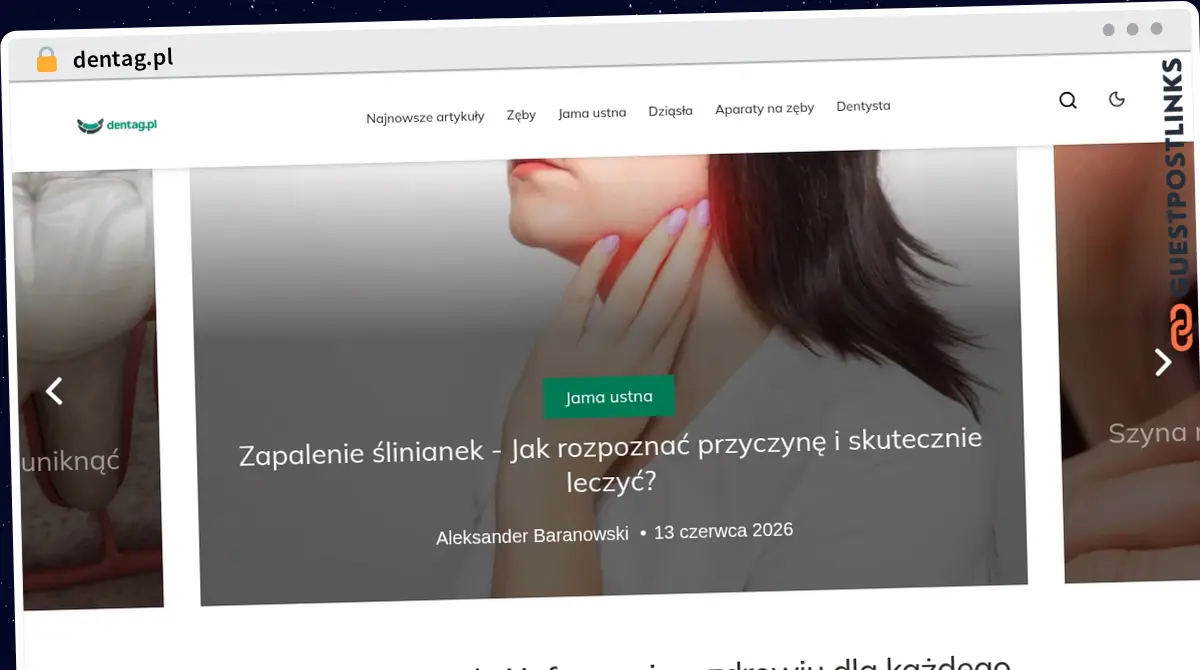 Publish Guest Post on dentag.pl