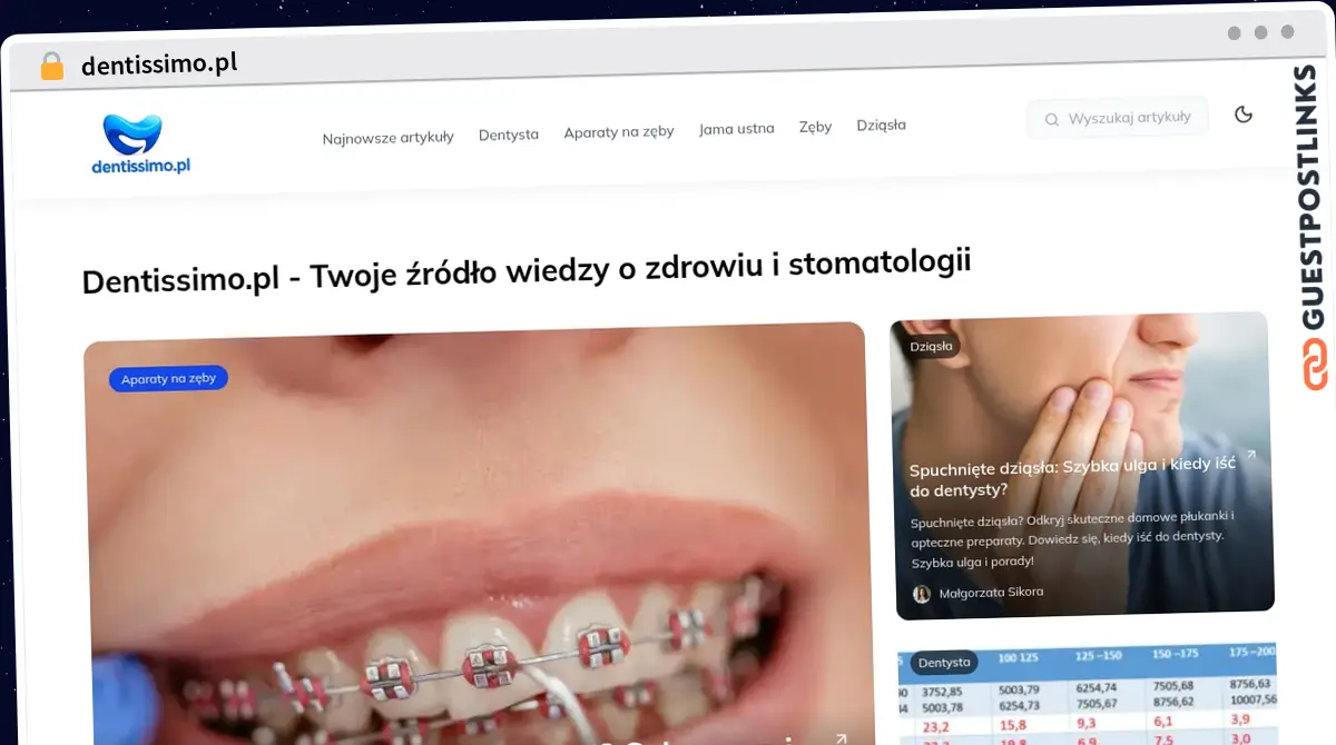 Publish Guest Post on dentissimo.pl