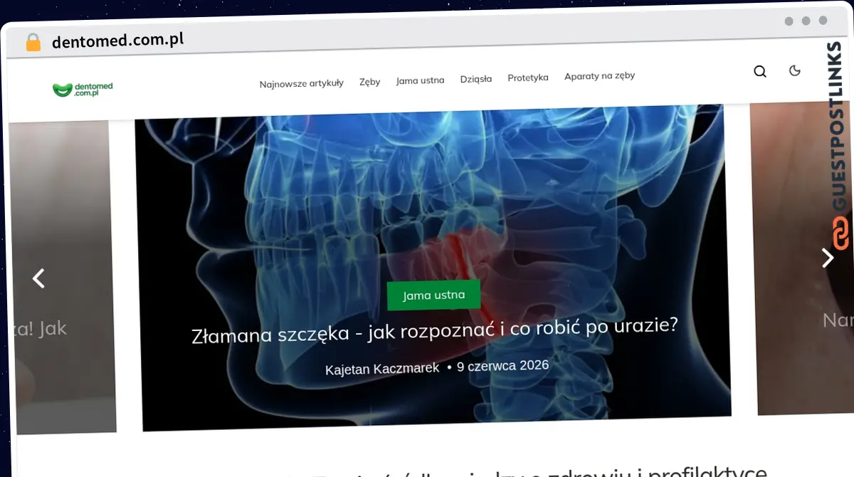 Publish Guest Post on dentomed.com.pl
