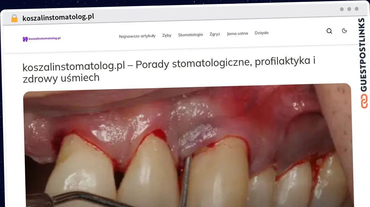 Publish Guest Post on koszalinstomatolog.pl