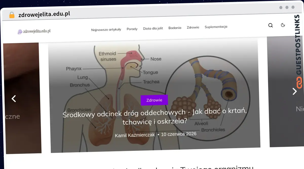 Publish Guest Post on zdrowejelita.edu.pl
