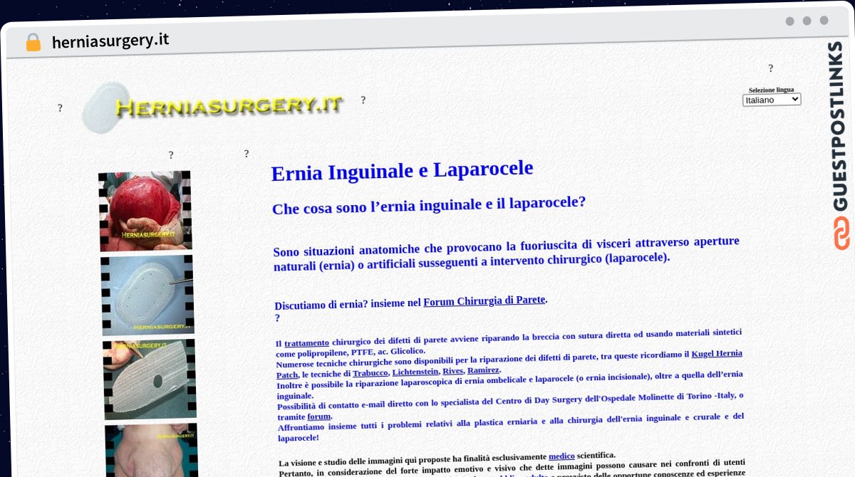 Publish Guest Post on herniasurgery.it