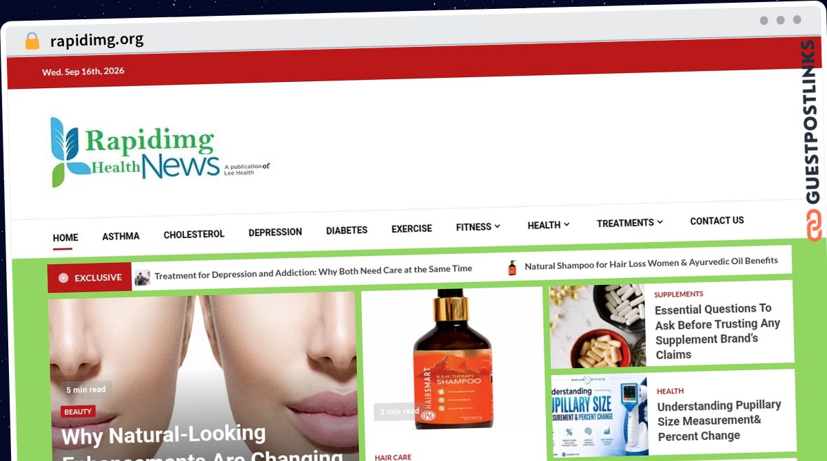 Publish Guest Post on rapidimg.org